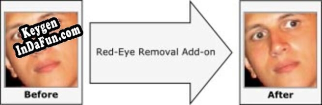 Aurigma Red-Eye Removal Add-on key generator
